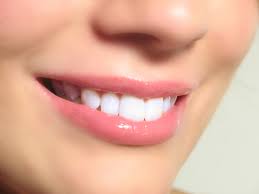 أسباب إصفرار الأسنان أحدث تقنيات تبيضها