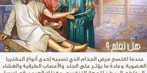 العرب ومرض الجذام